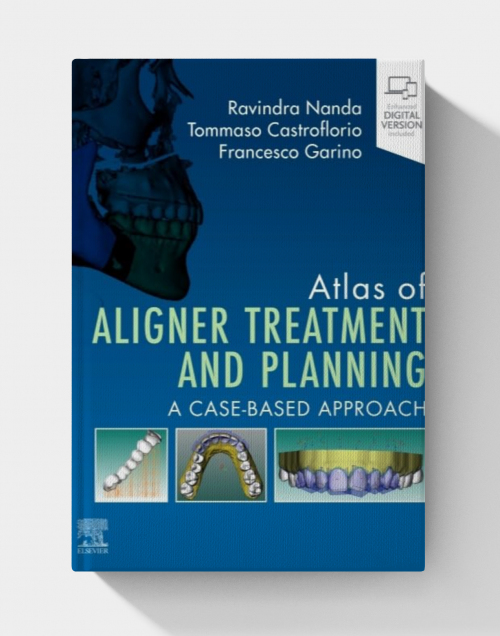 Atlas of Aligner Treatment and Planning: A Case-Based Approach (EPUB)