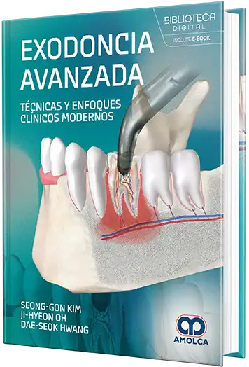 Exodoncia avanzada tecnicas y enfoques clinicos modernos