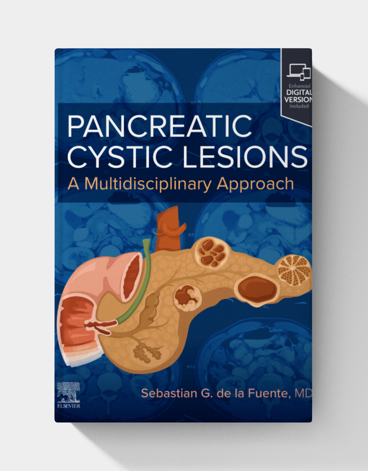 Pancreatic Cystic Lesions: A Multidisciplinary Approach (EPUB)