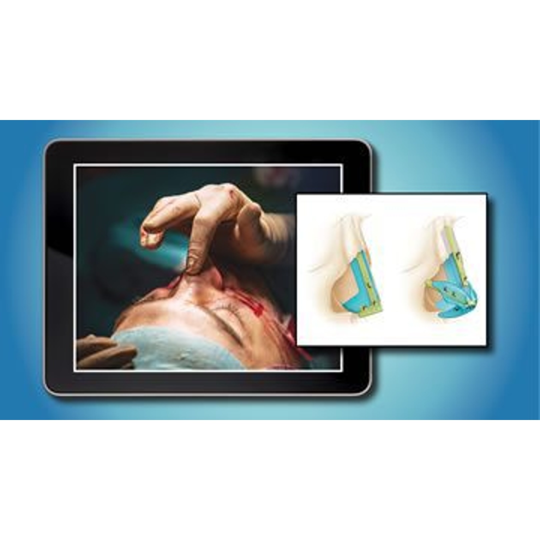 QMP e Learning Program – plastic surgery