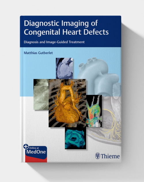 Diagnostic Imaging of Congenital Heart Defects: Diagnosis and Image-Guided Treatment