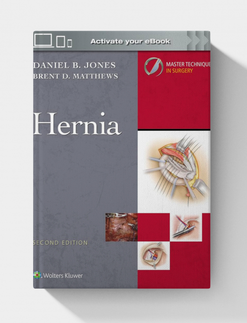 Master Techniques in Surgery: Hernia, 2nd Edition (EPUB + VIDEOS)