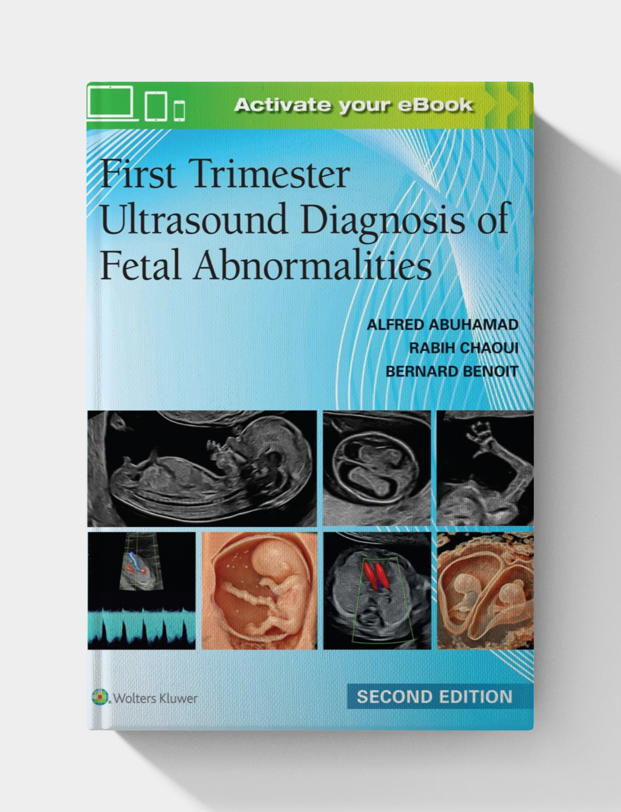 First Trimester Ultrasound Diagnosis of Fetal Abnormalities, 2nd edition (EPUB)