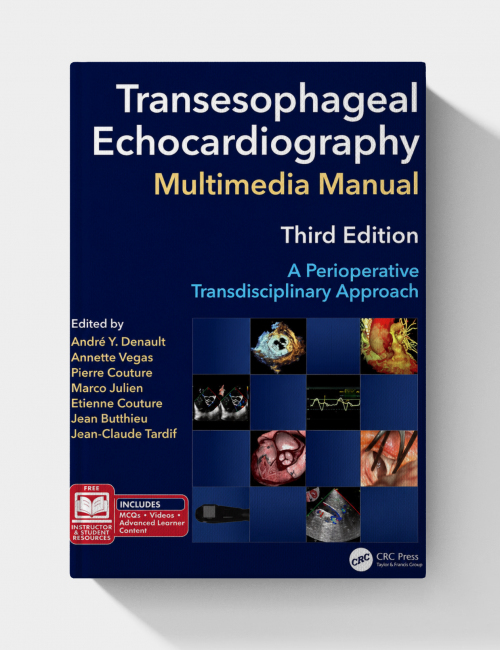 Transesophageal Echocardiography Multimedia Manual: A Perioperative Transdisciplinary Approach (3rd edition)