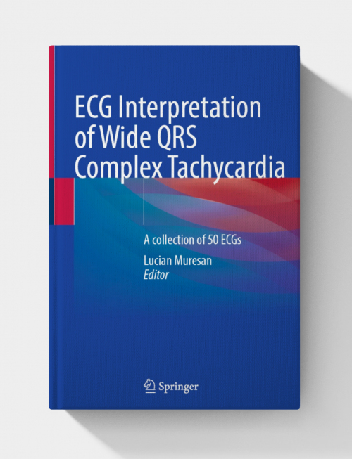 Interpretation of Wide QRS Complex Tachycardias: a collection of 50 ECGS