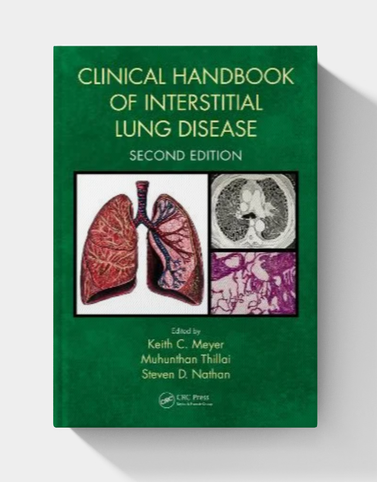 Clinical Handbook of Interstitial Lung Disease (2nd edition)
