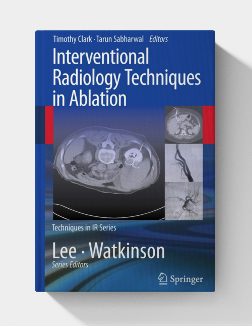 Interventional Radiology Techniques in Ablation