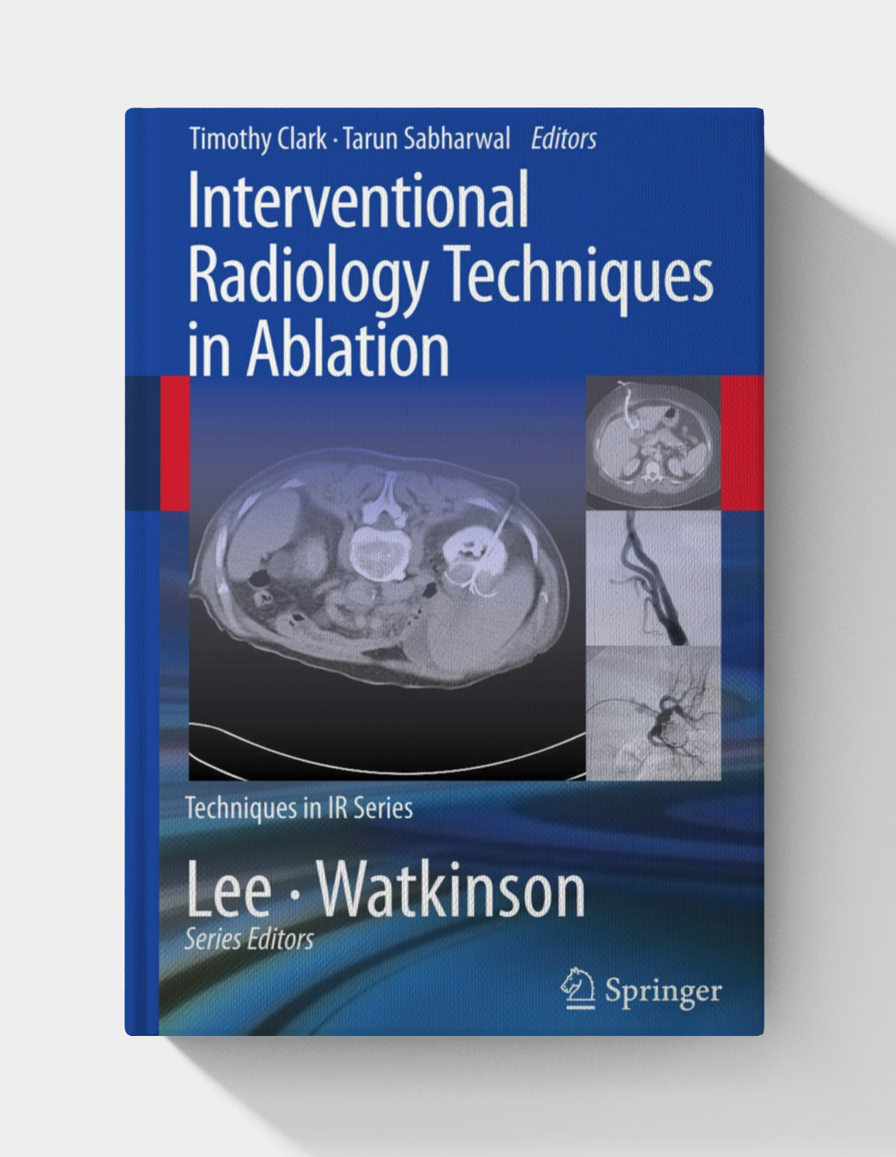 Interventional Radiology Techniques in Ablation