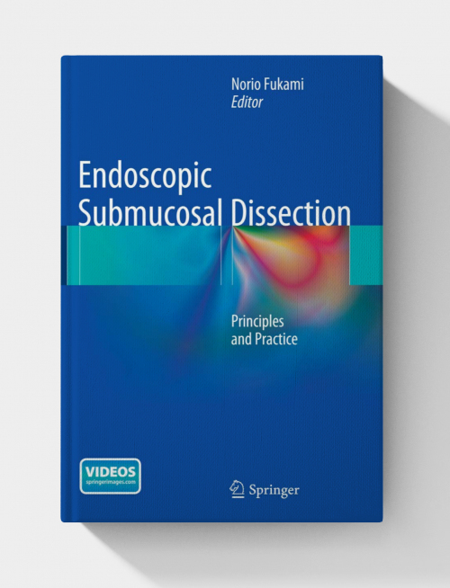 Endoscopic Submucosal Dissection: Principles and Practice (No videos)