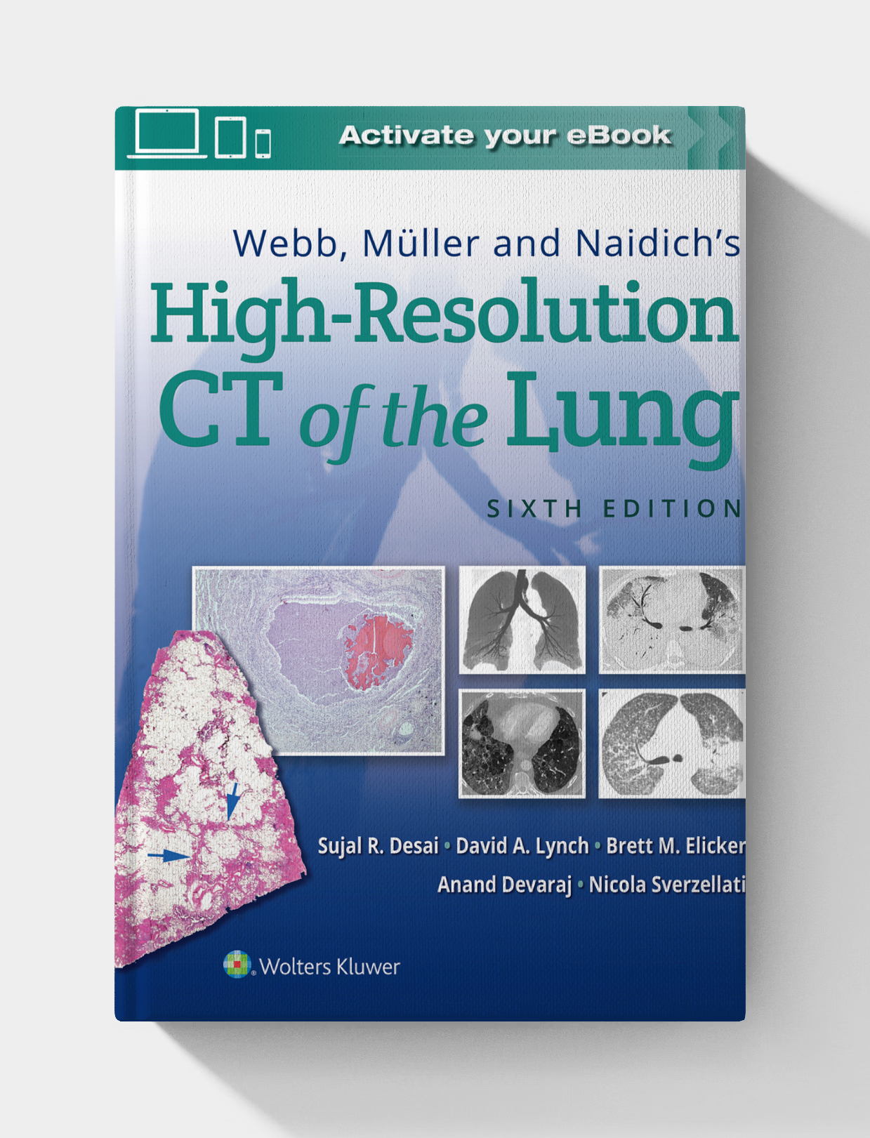 Webb, Müller and Naidich’s High-Resolution CT of the Lung (6th edition)