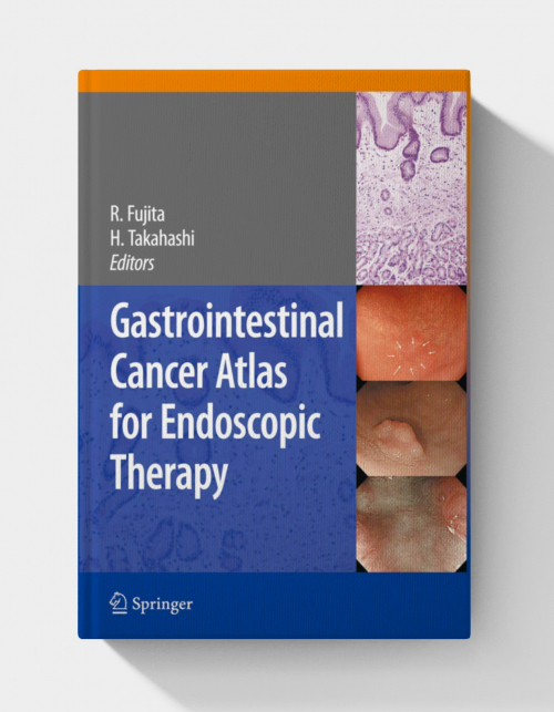 Gastrointestinal Cancer Atlas for Endoscopic Therapy