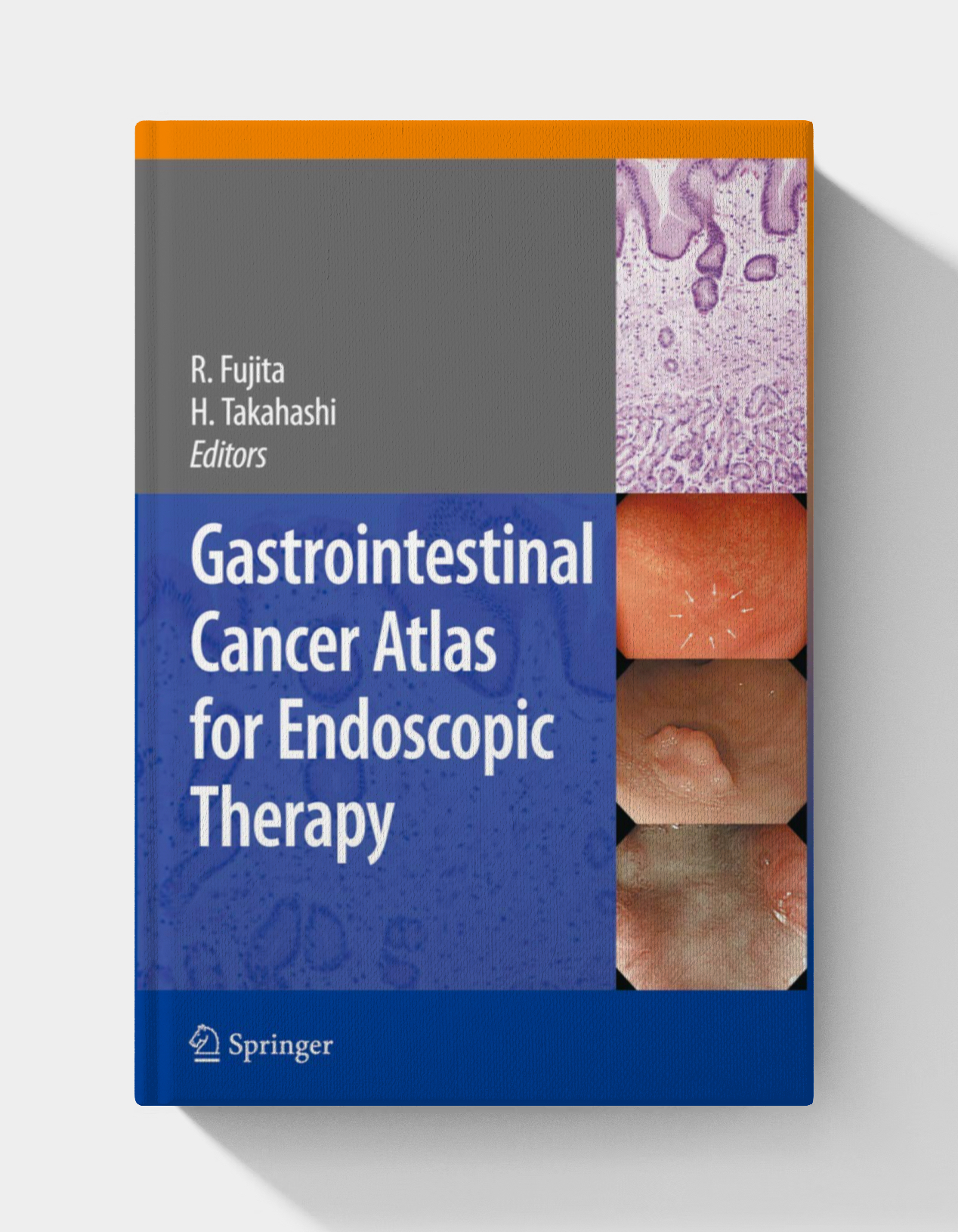 Gastrointestinal Cancer Atlas for Endoscopic Therapy