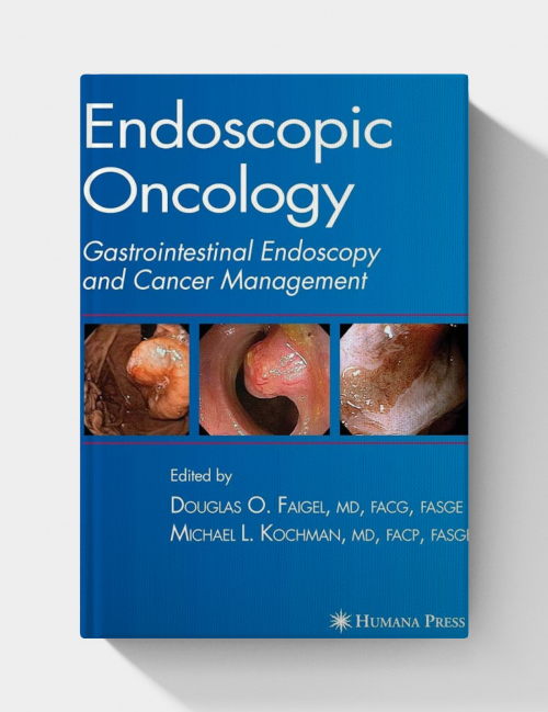 Endoscopic Oncology. Gastrointestinal Endoscopy and Cancer Management