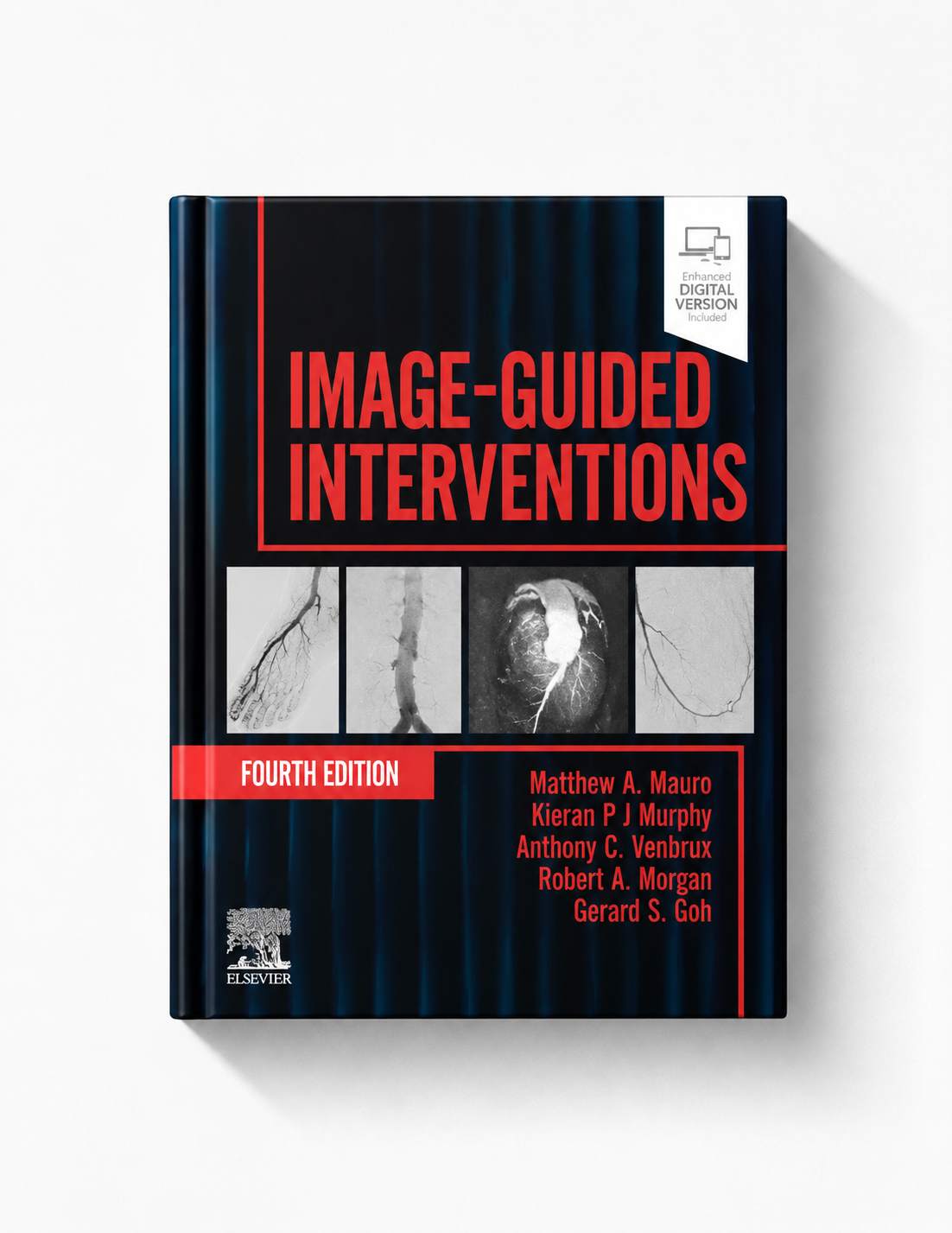 Image-Guided Interventions (Expert Radiology), 4th edition (EPUB)