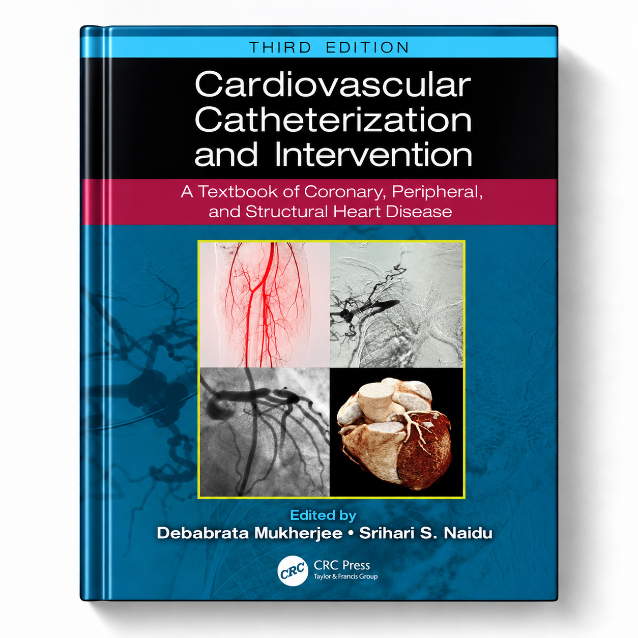 Cardiovascular Catheterization and Intervention: A Textbook of Coronary, Peripheral, and Structural Heart Disease (3rd Edition)