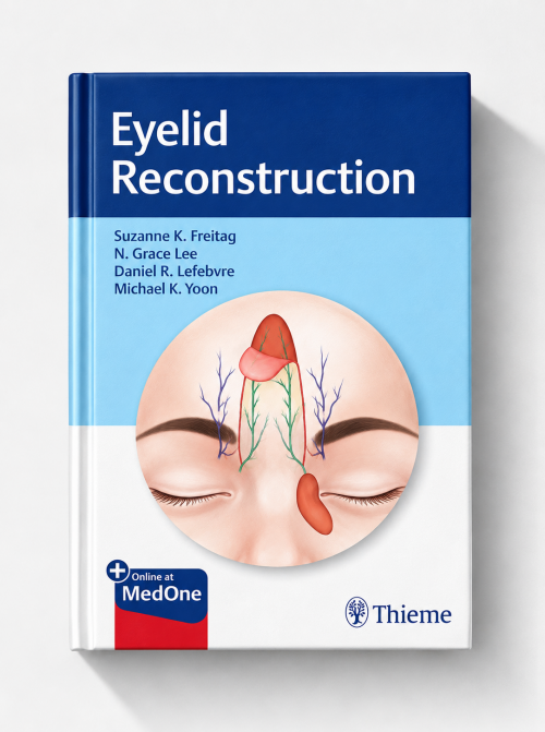 Eyelid Reconstruction
