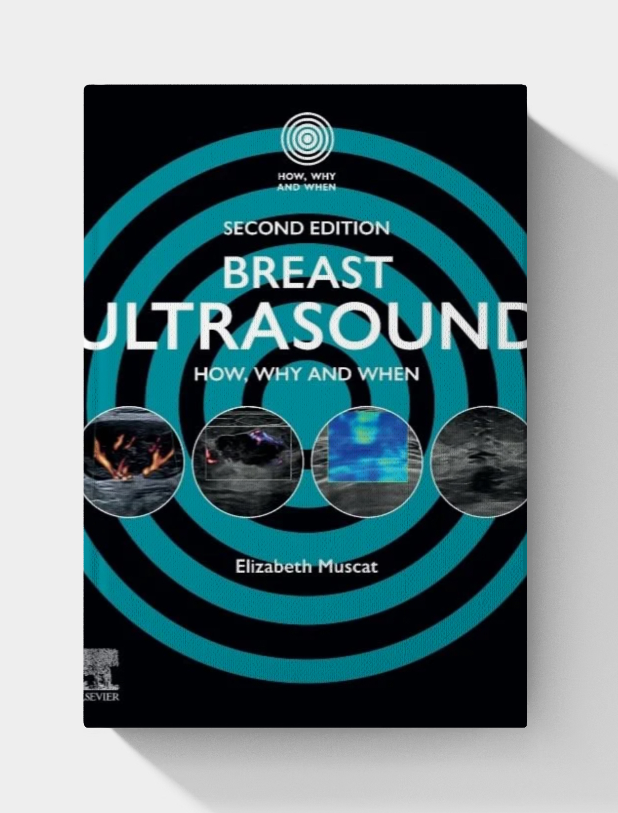 Breast Ultrasound: How, Why and When, 2nd edition (EPUB)