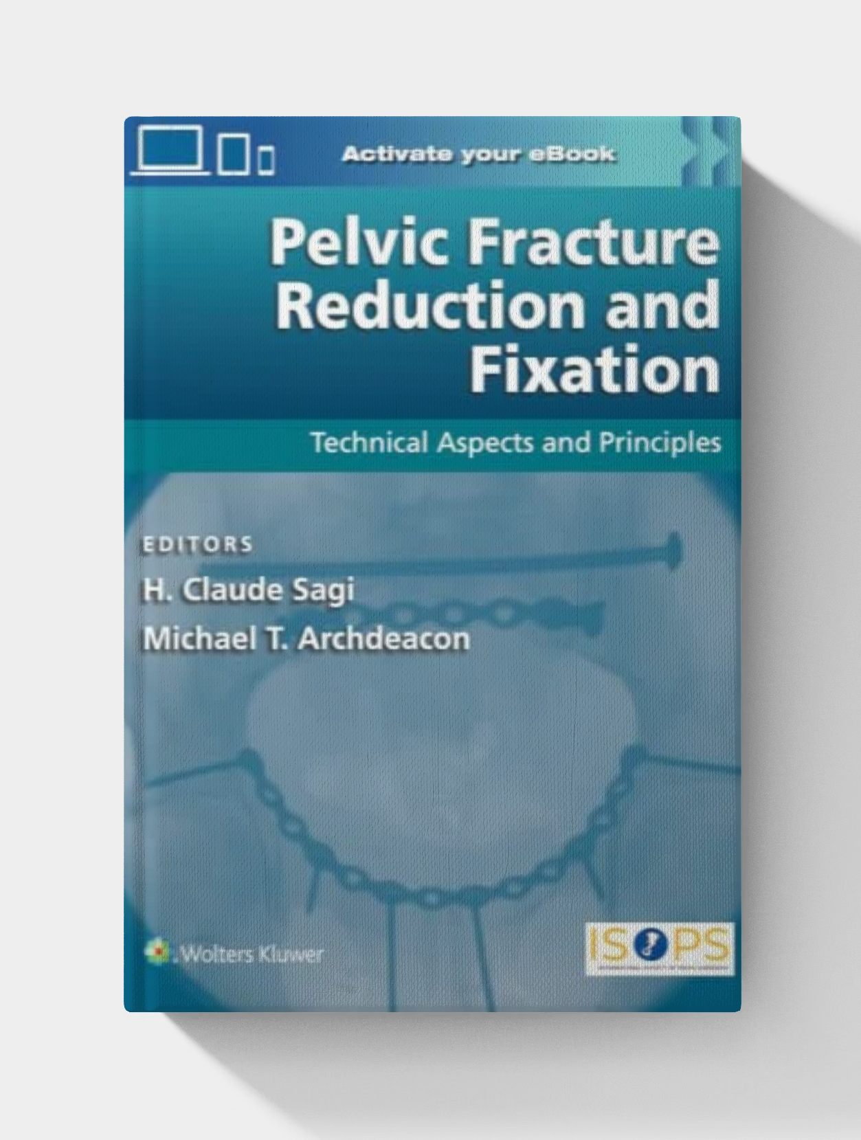Pelvic Fracture Reduction and Fixation: Technical Aspects and Principles (EPUB) PDF ONLY