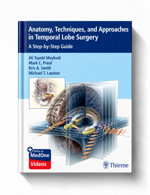Anatomy, Techniques, and Approaches in Temporal Lobe Surgery: A Step-by-Step Guide (Ebook+Videos)