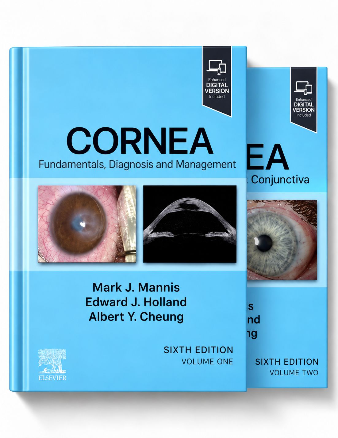 Cornea, 2-Volume Set, 6th edition (True PDF)